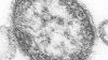 Opinion: What my colleagues and I will look for as we assess U.S. measles elimination status