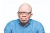 It’s just a gene: Can science replace myths about albinism?