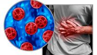 Cyclosporiasis spreads in Florida, Lee and Collier areas not spared. What to know