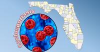 Florida cyclospora surges again with 87 new cases. More states link the cause to lettuce
