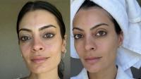 I Couldn't Mask Redness Even With Full Coverage Foundation — Until This K-Beauty Serum Came Along
