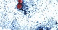 Florida reports 352 Cyclospora cases as lettuce-linked outbreak expands | See cases by county