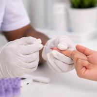 Agreement reached to expand early HIV diagnosis in the C’bean