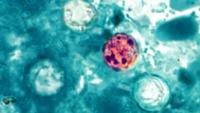 Nebraska Cyclosporiasis cases linked to national outbreak