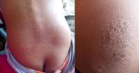 Cuban mother reports that the lack of water worsens her daughter's illness