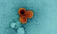 Severe COVID may awaken dormant viruses, leading to autoimmune disease, long COVID