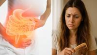 Ayurveda linked gut health with hair fall long ago: Expert decodes science behind connection