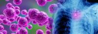 New Study Finds Bacterial Infections Affect About 1 in 20 Hospitalized Adults With Firearm Injuries