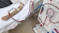 Tanzania, Africa50 agree to expand access to dialysis services for treatment of kidney diseases