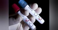 Weekly Oral HIV Treatment Noninferior to Daily Regimen, Trial Finds