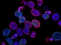 PRISM2 model uses clinical dialogue to interpret pathology slides