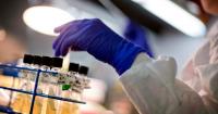 Stanford scientists just used AI to build a virus to target E. coli