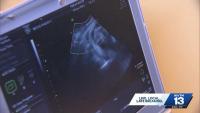 ACLU report says Alabama tops U.S. in pregnancy danger
