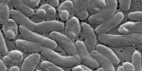 How to protect yourself from the bacteria linked to deaths of 5 Louisiana residents