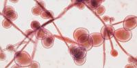 What to know about the drug-resistant fungus spreading through Michigan hospitals