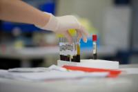 Getting an HIV Test Is Easier Than Many Americans Think, Including Free Kits Mailed to Your Door