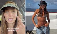 Australian model reveals her shock eye cancer diagnosis as she discovers she has a rare form of the disease: 'I had no idea it was a possibility'