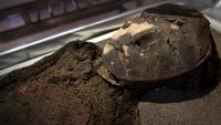 Scientists Found Smallpox DNA Hidden in 500-Year-Old Chilean Mummies
