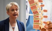 Government criticised for failing to roll out osteoporosis screening clinics in England - after it was revealed that NHS Wales has done so with 'relatively little investment'