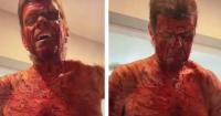 Celebrity Blogger Perez Hilton Still Hospitalized After Cutting Himself on TikTok Live, Will Need Surgery