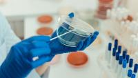 First ancient smallpox genomes found in the Americas tie disease to European colonization
