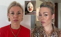I cancelled my 40th birthday party in Queensland to have a $32,000 facelift in South Korea. Five weeks later... here's everything I did to transform my exhausted complexion