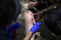Louisiana Confirms Five Vibrio Vulnificus Deaths, and All Nine Cases Began with a Wound