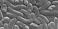 Flesh-eating bacteria infections are surging along the Gulf Coast with five deaths reported in Louisiana