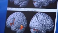 Healthy midlife habits could delay dementia by up to 13 years, study finds