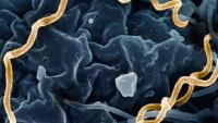 Sharp rise in Syphilis cases among men in Sri Lanka