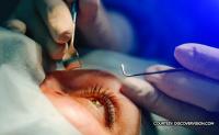 For clearer vision: Gov Sol Aragones launches free cataract surgery