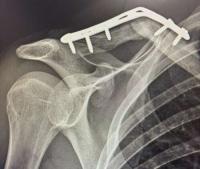 Kaden Hopkins finishes second after crash in Guadeloupe