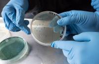 Vibrio on the rise as climate change warms the Chesapeake Bay