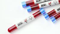 HIV Care Disengagement Common in Missouri