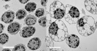 Scientists Uncover Cellular Mechanism Driving Both Rare Childhood Dementia and Alzheimer's Disease