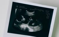 Texas AG Secures Emergency Court Order Requiring Life-Saving Care for Baby in Dallas Parentage Dispute