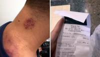 ‘Pressured into buying it’: Tourists who have stiff neck and wanted a plain massage paid nearly $ 1,000 on treatments in a Chinese medicine clinic