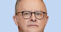 Australian PM under fire for 'crude' joke about Takaichi melon gift