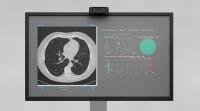 RevealDx announces distribution agreement and investment from 4DMedical