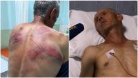 Serbian Church demands action over beating of parishioner in Kosovo