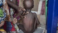 Nigeria’s stunted future: New analysis puts the cost of 60 years of child nutrition neglect at $412 billion
