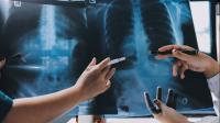 Baton Rouge General gets $30K grant to expand lung cancer screenings in Louisiana