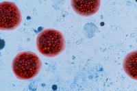 Michigan Cyclosporiasis Outbreak Surges Past 13,900 Cases, Up More Than 1,400 in One Week