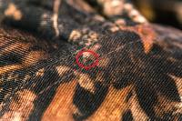 Second Powassan case of 2026 confirmed; RI health officials urge precautions to reduce tick exposure