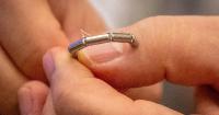 At this Baton Rouge hospital, magnets are doing the job that stitches and staples used to do