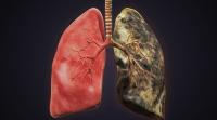 Trump’s Gift To Coal Miners: Less Coal Jobs, More Black Lung Disease