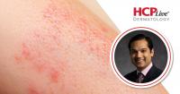 Q&A: Bimekizumab 2-Year Efficacy by HS Disease Duration, With Raj Chovatiya, MD, PhD