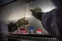 CDC Detects a Resistance Gene in a Massachusetts Bacterial Sample That Routine Lab Tests Would Likely Miss