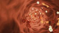 Health Spotlight | Why anemia might be more than just a lack of iron