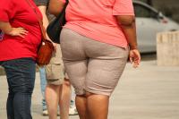 Nearly half of U.S. adults will have obesity by 2035, study warns
